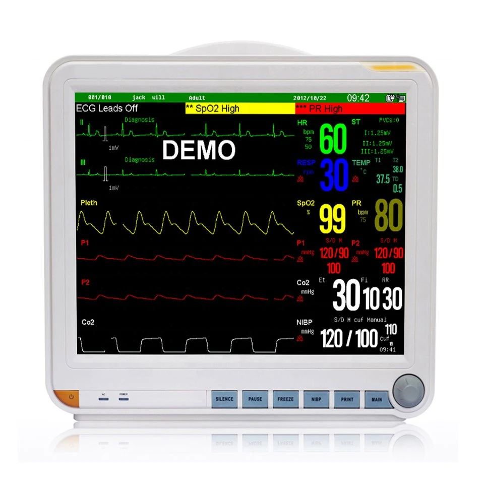 Monitor multi-de paràmetres veterinaris